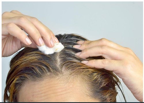 How To Use Coconut Oil For Hair Dandruff?